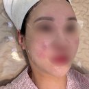 더리터성성호수점 | 천안 피부관리 더맑은스킨 천안성성호수점 후기 💆🏻‍♀️ :: 천안성성동피부관리 천안에스테틱 천안이중턱...