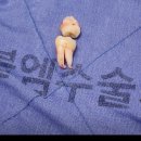더블엠구강악안면외과치과의원 네이버블로그