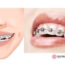 투명한이치과교정과치과의원 네이버블로그