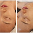 CU연제연산점 | 부산 연산동 피부관리 | 리하에스테틱 | 광채뿜뿜 수분관리 후기 연산동 에스테틱 추천