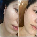 2SSUNY | 부산여드름관리 잘하는곳 화명동에스테틱 오태선피부연구소 후기