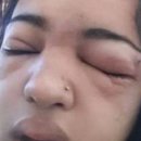 셀프피어싱 네이버블로그