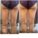 세니떼뷰티샵청학점 | 아미다인 에스테틱 | 연수동피부관리 | 슬리밍관리 | 지방흡입후관리
