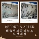 월드헤어라인 | 부산대두피관리 헤솔두피클리닉스 헤어라인 교정 전문센터 후기