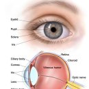 눈암. 눈꺼풀암. 안암의 정의 이미지