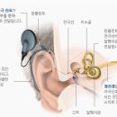 와우히어링 이미지