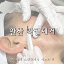 안산스킨플래닝 3세대스킨플래닝 얼굴 잔털제거 후기 에스테틱 온리쉬