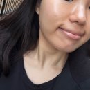 창조데이타 | [대구에스테틱] 급노화 고민 해결! 노멀리즈에스테틱 창조경제단지점 후기