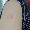 자운가정의원 | [노바백스.접종.후기]당일.노바백스1차.부작용.