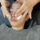 강남 블랙헤드 보름달뷰티 강남 논현본점 문제성피부 모공관리 플라즈마