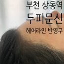 이수연헤어라인