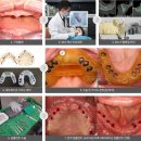 이천치과기공소 이미지