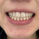 e-조은 치과의원 | 신사역치과 원데이치아미백 찐후기 레브치과 강남점