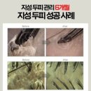 세븐일레븐 부산중구국일점 | [부산/중구] 헤솔두피클리닉스 롯데광복점 방문후기 부산남포동두피관리 추천 줄기세포 탈모관리
