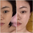 턴업 | 마두 피부관리 에너지테라피 작은얼굴관리 턴업에스테틱 솔직후기