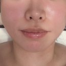 글로비지테라안티에이징의원 이미지