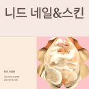 달콤네일/스킨스토리 | [청주 사창동 수분관리] 니드 네일&amp;스킨