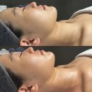 뉴키 - 성남시 분당구 | 청담스킨케어 디프네 바디관리 받고 리프팅되고 다크서클 사라진 솔직 후기 (feat. 버디 뉴키)