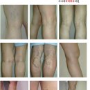 아나파적맥통증의원 Daum카페