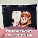 인쇄하다 | 임산부 일기 21주차) 정밀초음파 검사 후기