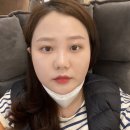 한사랑노노의원 | 수술 없이 인상시술로 예뻐지기 에어젯 솔직후기 (압구정한사랑노노의원) 내돈내산!