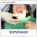 달성더원치과의원 | 달성더원치과의원 : 35개월 영유아구강검진
