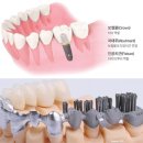 디오(The O)치과기공소 | 디오....완전히 새 될뻔 했네