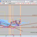 인트로메디칼 이미지