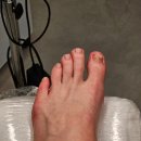 기흥로L-1 | 말못할 고통 내성발톱 하이푸스 기흥구청점