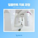 에센스치과기공소 이미지