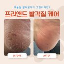 하얀네일 | 겨울철 하얀 발뒤꿈치 케어 이렇게 하세요! 프리앤드 네일 관리 후기