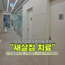 수성한의원 | 수성구 피부과 한의원 새살침 치료 패인흉터치료 2회차 리얼후기