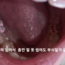 이태현치과 네이버블로그