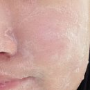 스노우가든 | 솝24 스노우가든 팩솝, 여드름 관리까지 되는 신개념 클렌징 비누!