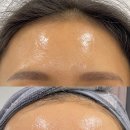 노노메디칼 이미지