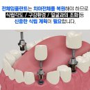 느낌이있는필치과의원 | 평택 고덕동 치과의원 전체임플란트로 치아 되찾기!