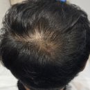 유진원 | 양산 남자 새치염색 구렛나루 검은 얼룩 없는 톤다운! 두피전문헤어룸손길 맞춤 뿌리염색 (ft. 비포에프터)