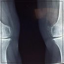 참좋은재활의학과의원 | 지긋지긋한 목 통증, 이제 안녕! 동작에스엔재활의학과의원에서 찾은 희망