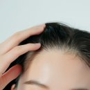닥터헤어리의원 네이버블로그