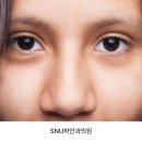 SNU하안과의원 이미지