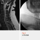 콕마취통증의학과의원 네이버블로그