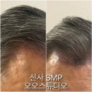신구초등학교 | [신사 SMP] 오오스튜디오 | 신사두피관리 강남정수리커버 신사탈모관리 1회차 후기