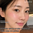 온다리프팅 내돈내산 후기통증 가격 유지기간 이중턱 6만줄 효과 솔직리뷰