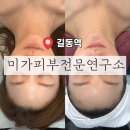 미가피부전문연구소 | ［ 강동 / 길동역 ] 둔촌동피부관리 미가피부전문연구소 | 플라즈마 리프팅케어
