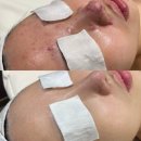 온에스테틱 | 광주피부관리샵 상무지구 온에스테틱 만족후기