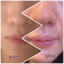 다농마트 건너편 공영주차장 방향 | 여주피부관리 "소담라인피부샵" 정성스러운 전문적인 케어샵