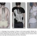 한국보조기 이미지