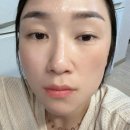아이노스피부 네이버블로그