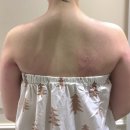 상지초교 | 대전 유성 노은 피부, 체형 관리 맛집] 마블린에스떼 라운드 숄더 관리 솔직후기 전후비교, 거북목 탈출?!?