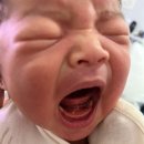 좌동순환로 301 | 해운대 좌동 이인훈소아과 설소대 수술 후기 / 현대해상 설소대 태아보험 청구 혀유착증